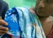 Tangan Kanan Arjo Putus Diterkam Buaya